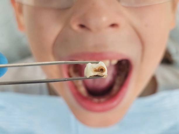Best Emergency Pediatric Dental Care in Gustine, CA